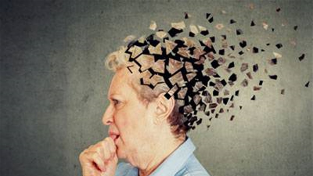 دراسة تحدد عوامل جديدة للوقاية من الخرف