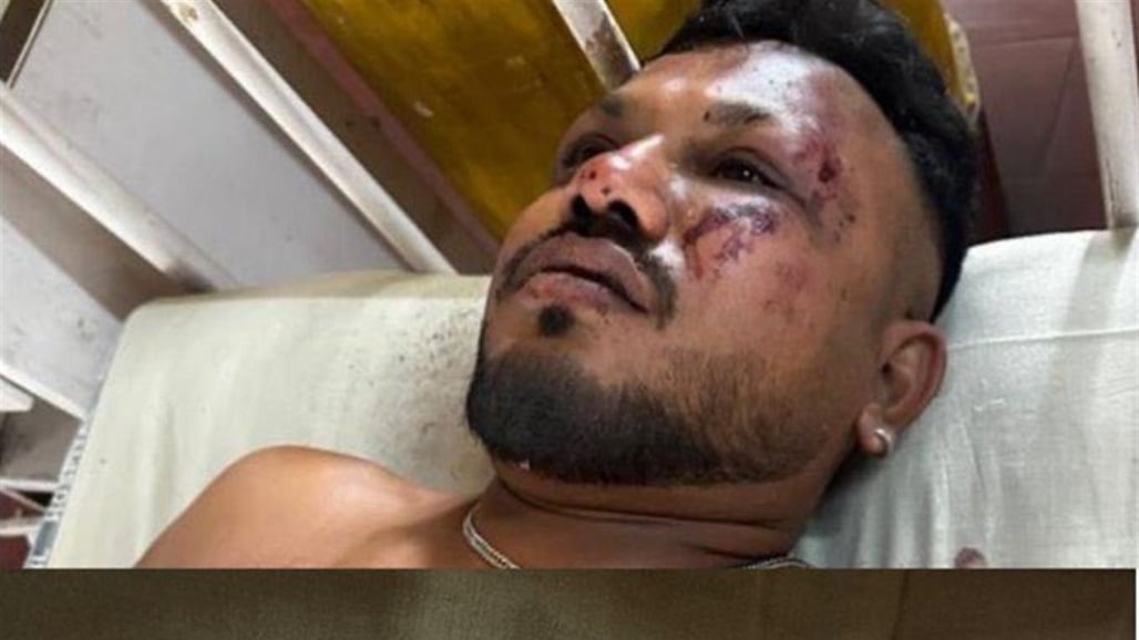 من بين 242 راكباً.. مشاهد لخروج الناجي الوحيد من تحطم الطائرة الهندية 