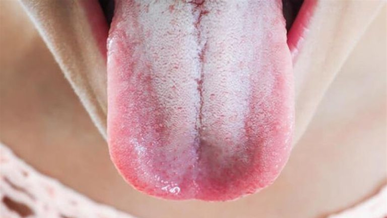 لسانك اول المحذرين.. الذكاء الاصطناعي يكتشف السكري وسرطان المعدة من الفم 