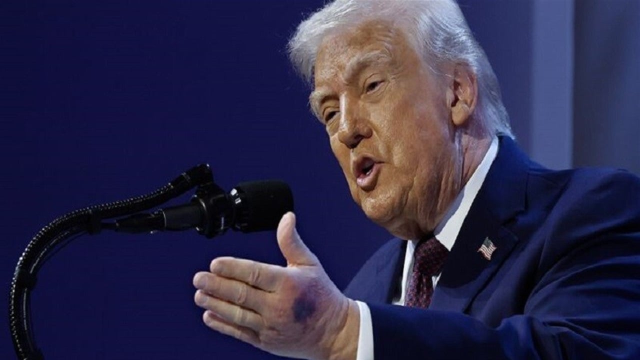 كدمة على يد ترامب في منتدى "دافوس"