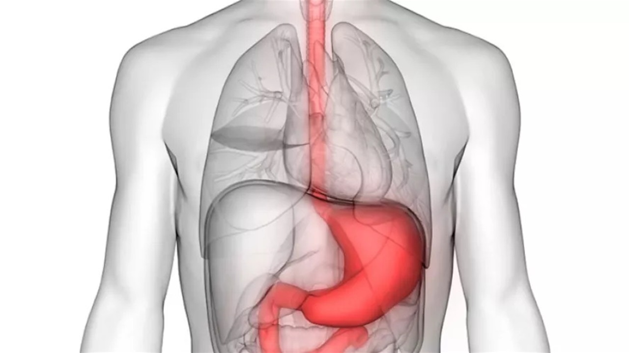 دراسة تكشف كيفية التخلص من حرقة المعدة دون أدوية