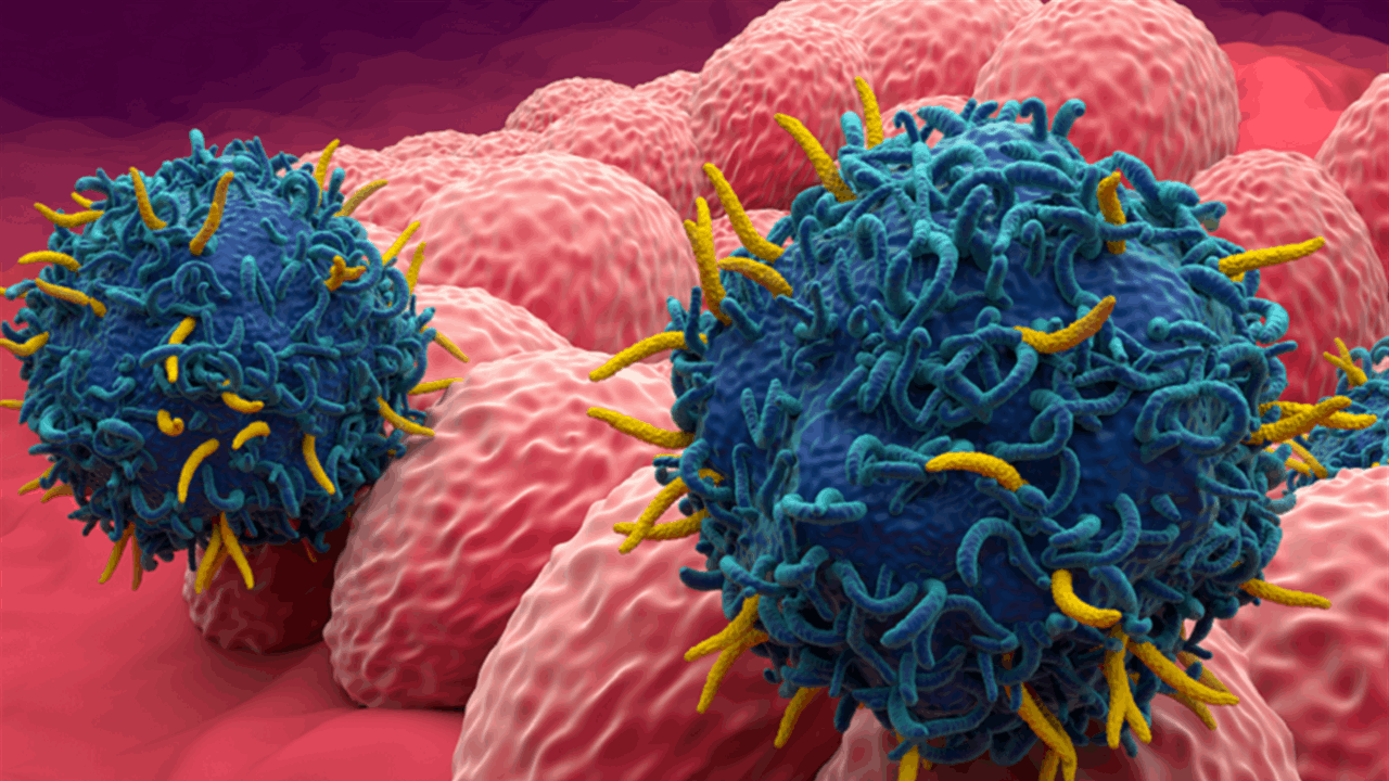 هل يقلل النشاط البدني من خطر الوفاة لدى مرضى السرطان