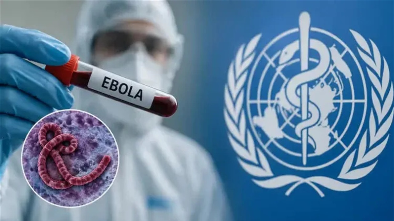 الصحة العالمية تعلن عن أول حالة شفاء من الإيبولا