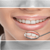 خطوات بسيطة لأنقاذ أسنانك من التساقط مع التقدم بالعمر.. ما هي؟ 