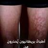 وضع اللابتوب على جسمك قد يكلفك صحتك!