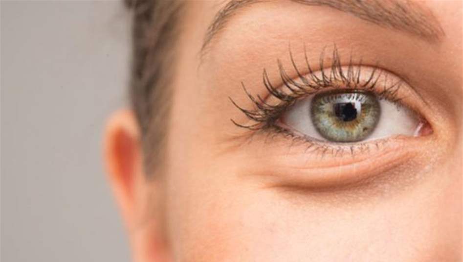 علاجات منزلية للتخلص من الانتفاخ تحت العين