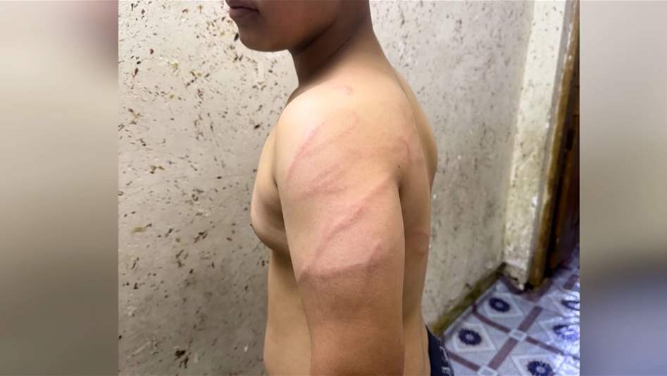 طالب يتعرض للتعــ نيف بواسطة "كابل كهربائي"