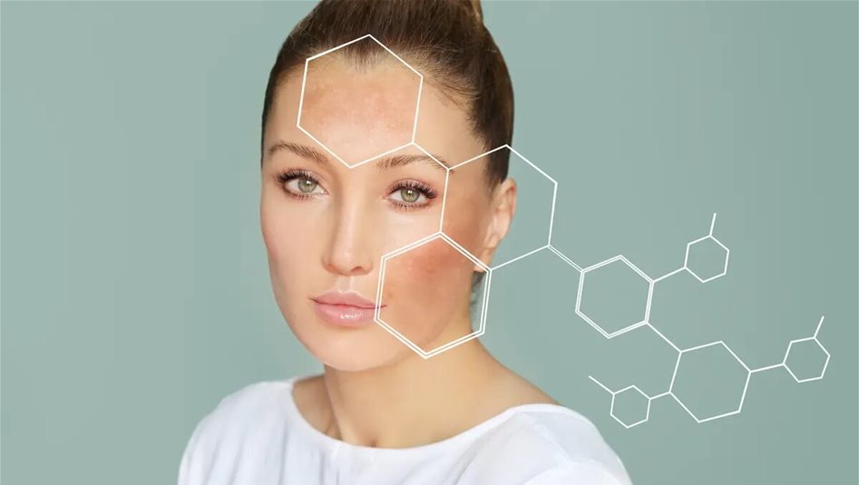 وداعا للبقع الداكنة وصفات طبيعية لبشرة صافية 