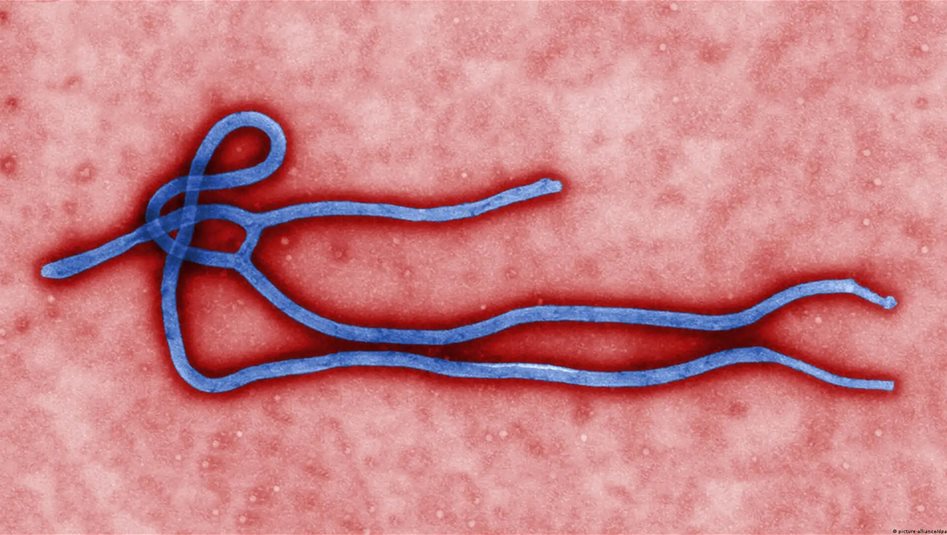 DSÖ: Ebola nedeniyle 139 ölüm, 600 şüpheli vaka