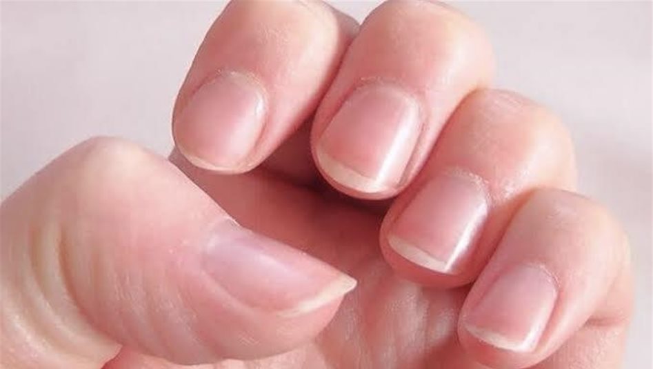 علامات قد تكشف مشكلات صحية خطيرة