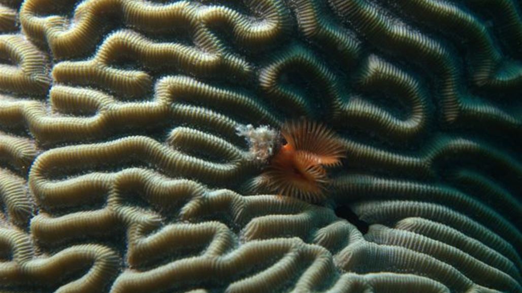 العثور على دودة في دماغ بريطاني