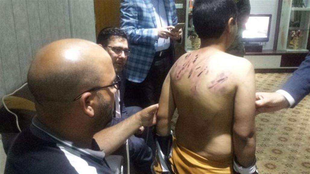 امانة مجلس الوزراء توجه بمتابعة حالة طفل تعرض لضرب مبرح من والده