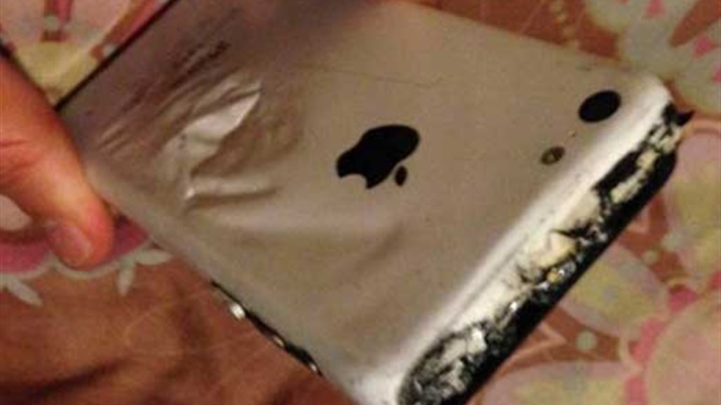 هكذا انفجر هاتف آيفون في جيب طفلة