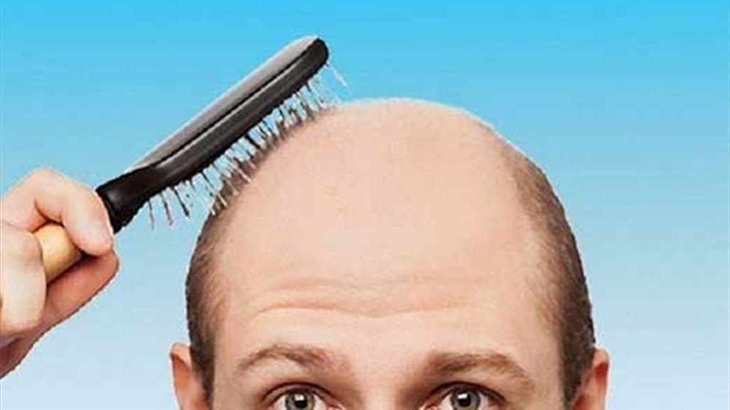 اكتشاف دواء لمحاربة الصلع في 10 أيام