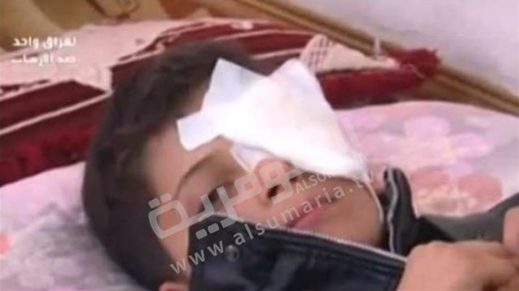 تلميذ يفقد إحدى عينيه على يد معلمته في كركوك