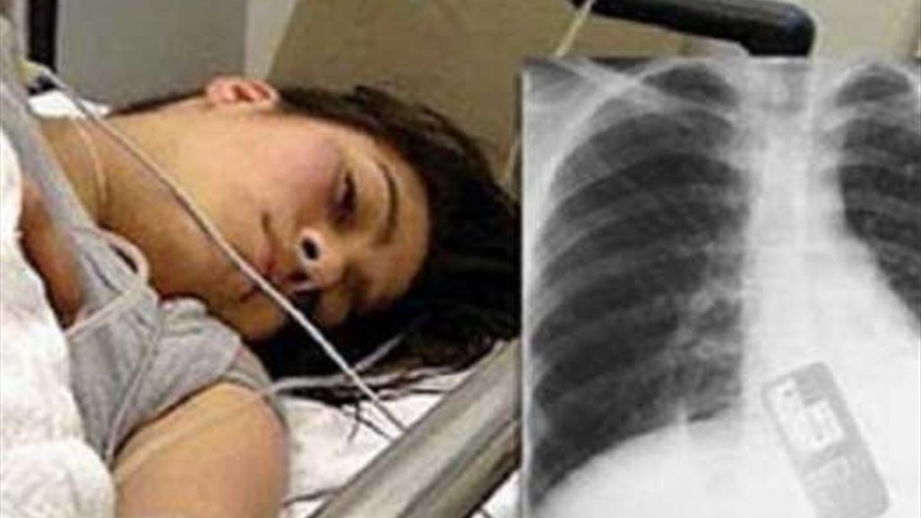 ابتلعت هاتفها  خوفاً من صديقها