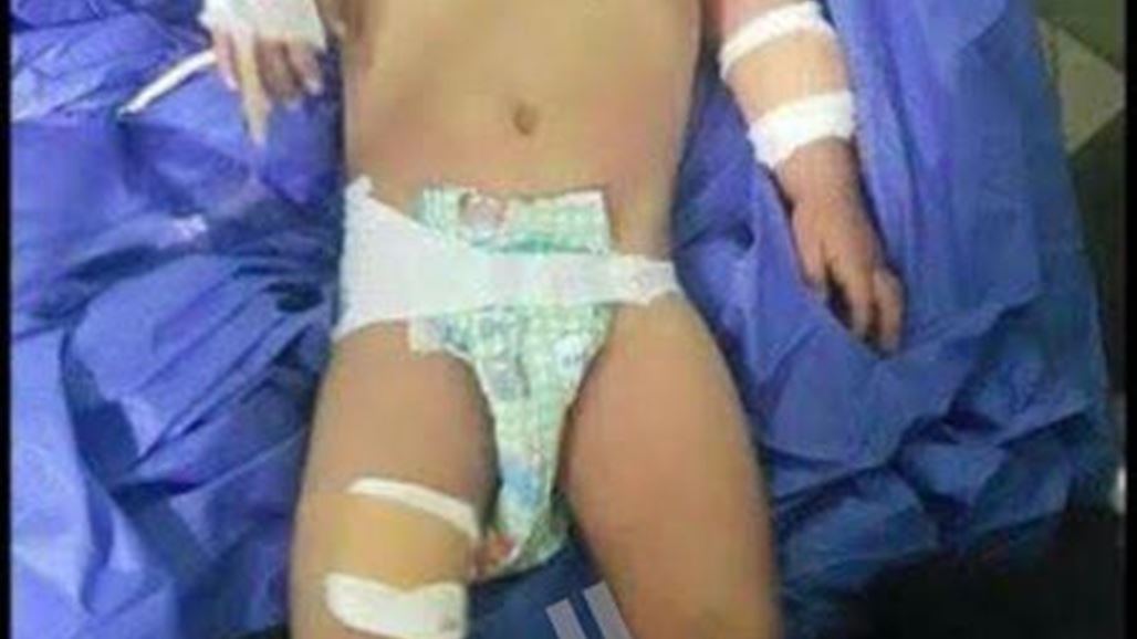 وفد طبي ايراني يصل الى تازة