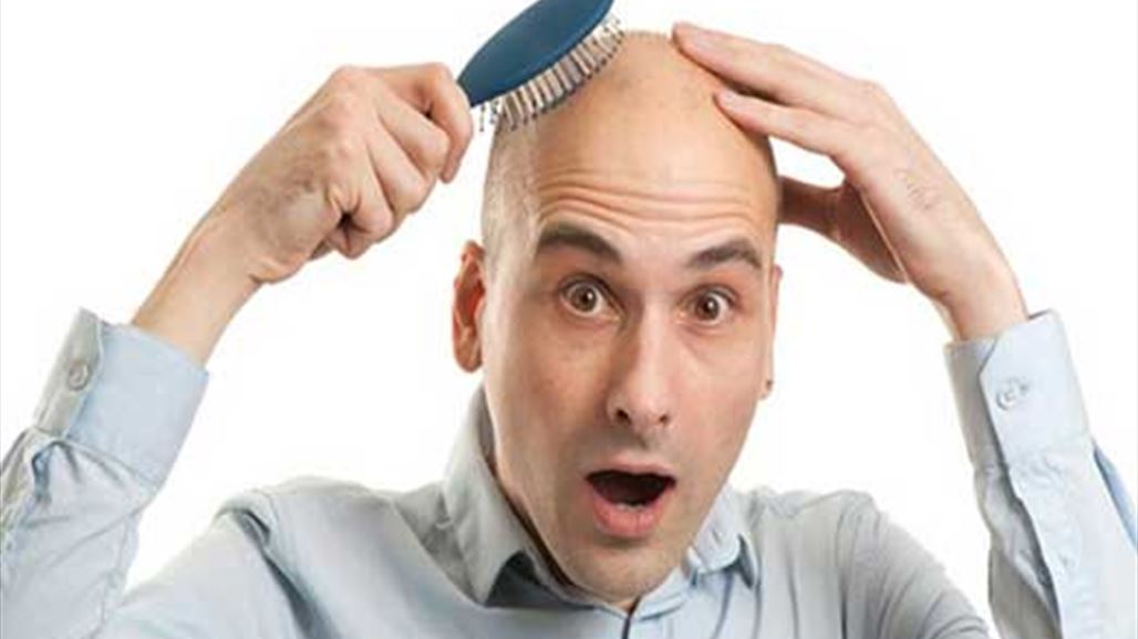 كيف تقي نفسك من الاصابة بالصلع؟