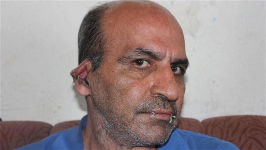 لاجئ إيراني في تركيا يخيط فمه وأذنيه تعبيرا عن سخطه