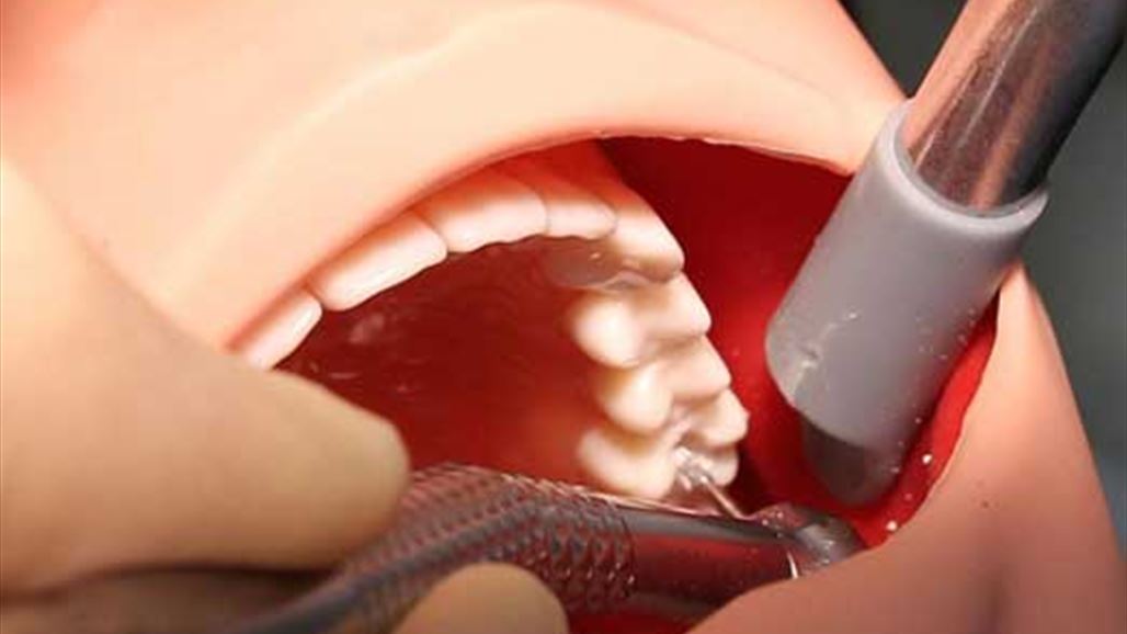 بديلٌ جديد عن الحشو التقليدي للأسنان