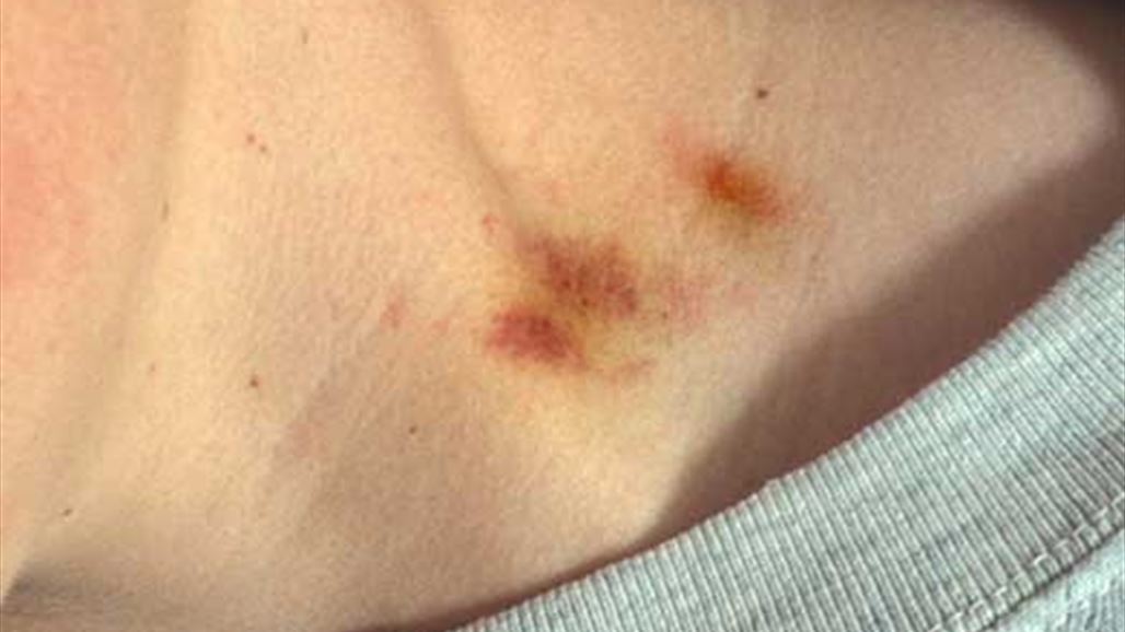 توفيّ بعد أن قبّلته على عنقه