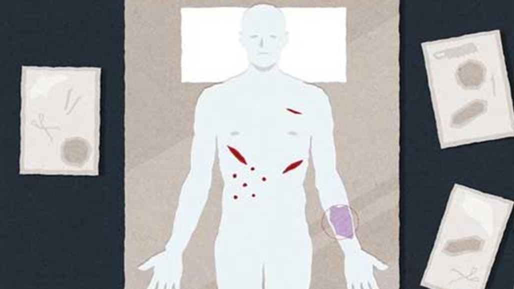 بالتفاصيل...هذا ما يحدث عندما يقوم الأطباء بتشريح الجثث