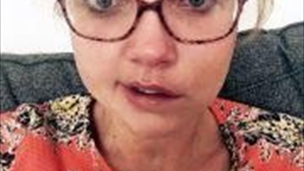 استيقظت من النوم لتجد نصف وجهها مشلولاً