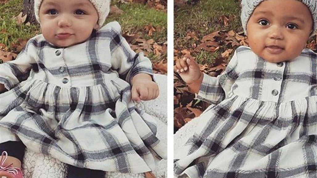 صورة هذا التّوأم تحيّر روّاد الإنترنت!