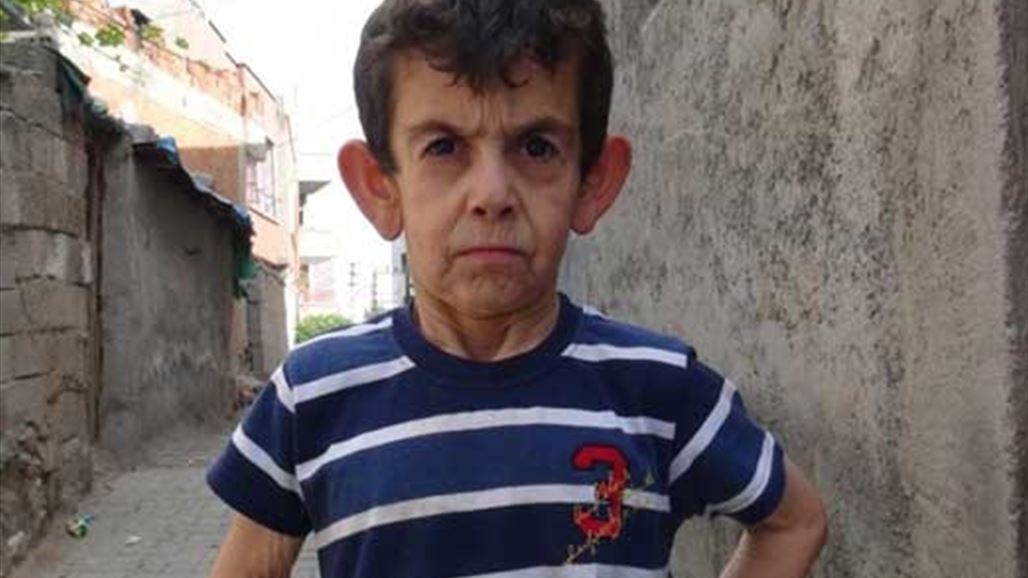 محمد طفل في جسد رجل عجوز وحلمه أن يكون "وسيماً"