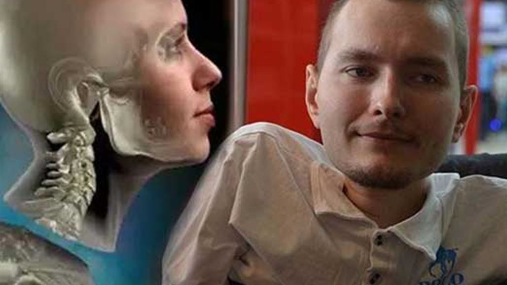 قريبا..أول عملية جراحية لزراعة رأس كامل في العالم