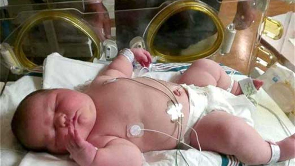 بالصور: أضخم مولودة في العالم تثير ضحك الأطباء