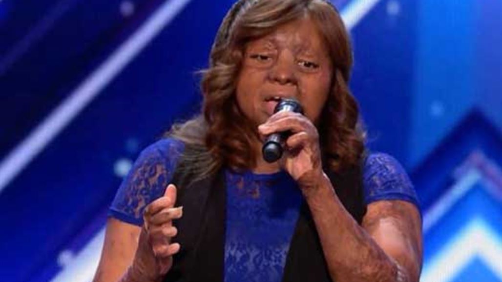 ناجية من تحطّم طائرة تخطف قلوب لجنة تحكيم America's Got Talent