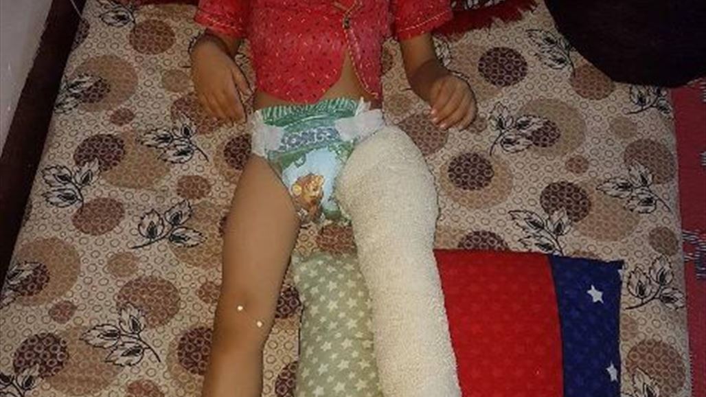 عائلة طفل نازح تناشد الصحة بإجراء عملية له بعد تعرضه لكسر اسفل عربة قطار في كركوك