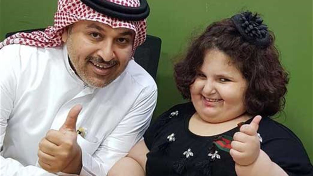 بالصورة: طفلة عمرها 5 سنوات بوزن 85 كلغ!