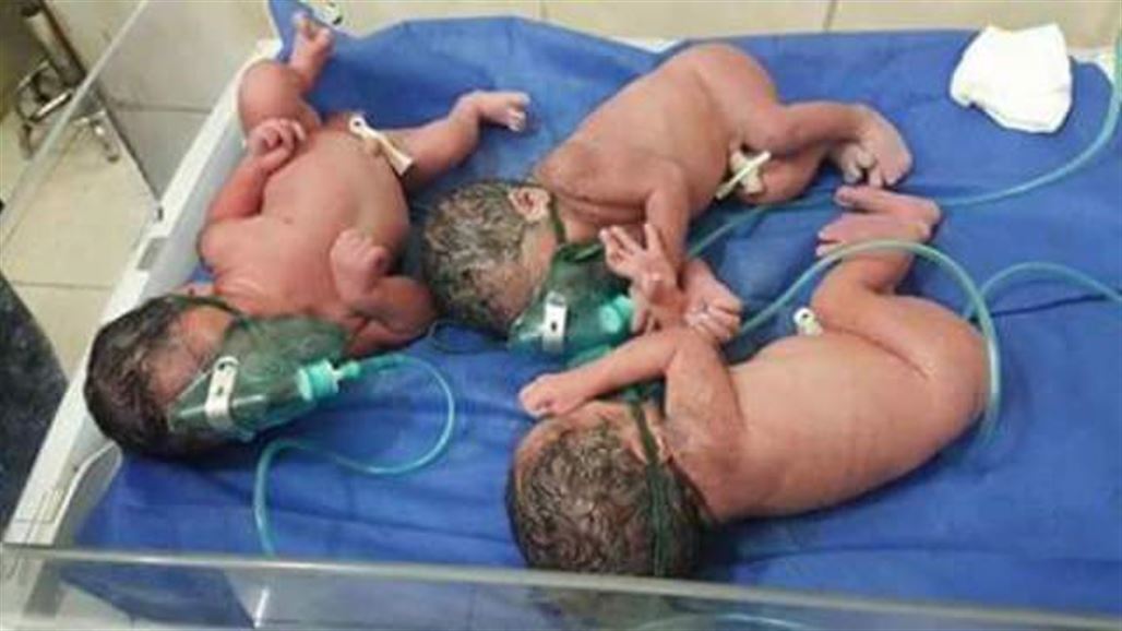 إمرأة تنجب ثلاثة توائم في حالة هي الرابعة من نوعها خلال أسبوع في ديالى