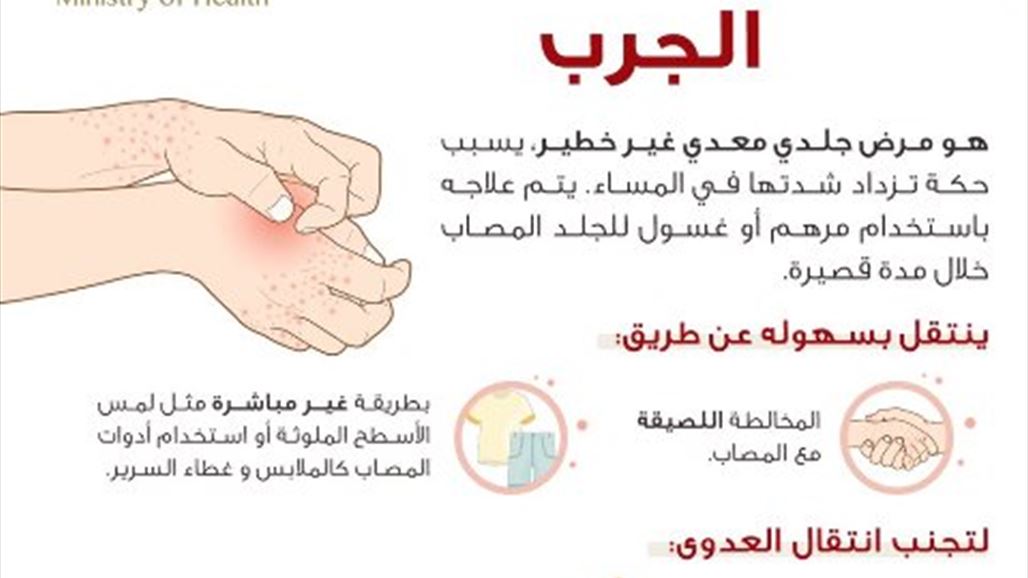 السعودية: 2156 إصابة بالجرب في مكة المكرمة