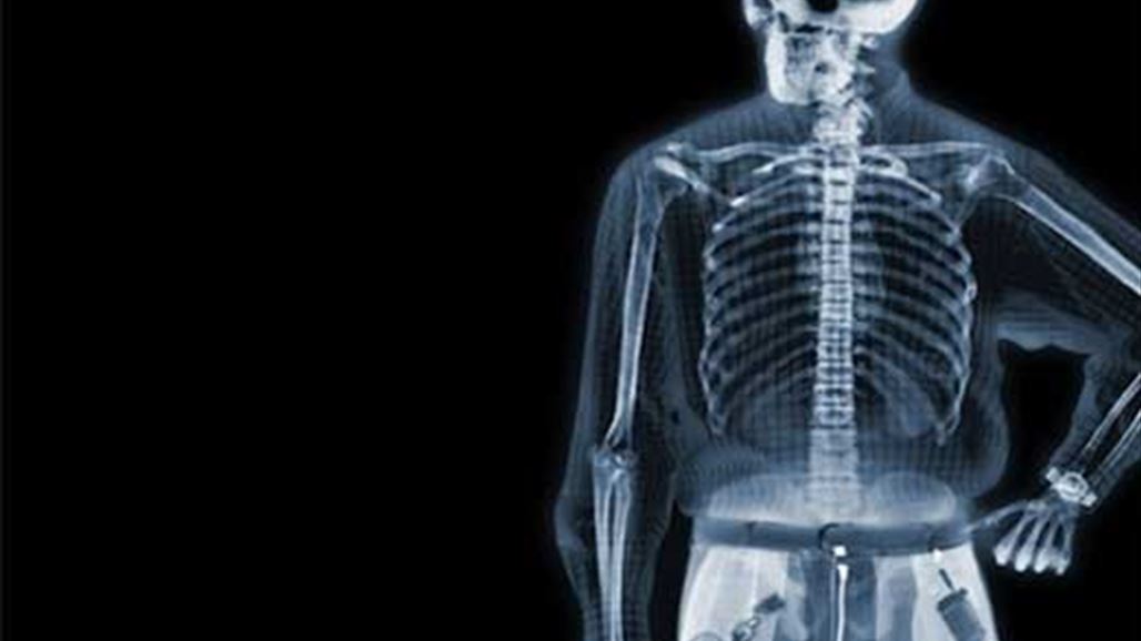 هل صحيح أن صور الأشعة أصبحت ملونة؟