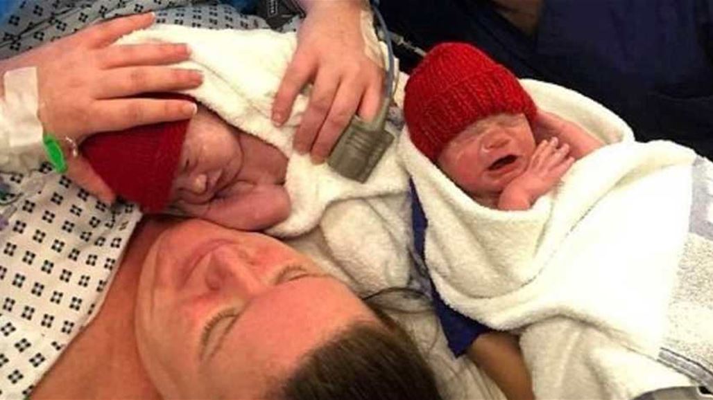 ولادة نادرة تحدث مرّة بين كل 500 مليون سيدة