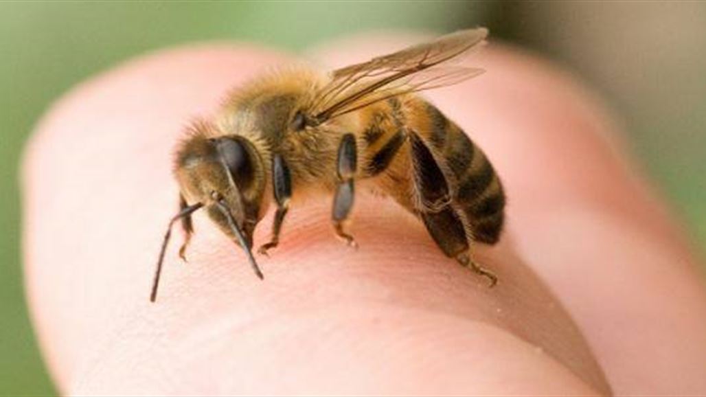 وصفات منزلية لعلاج لدغات النحل