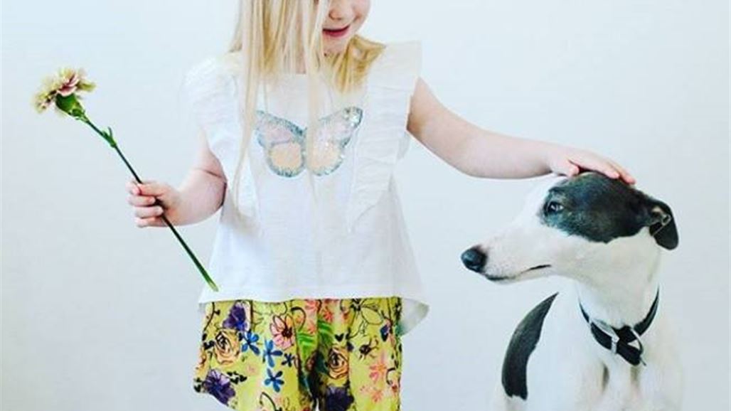 بالصّور: طفلان مصابان بمتلازمة داون يتحولان إلى عارضين شهيرين