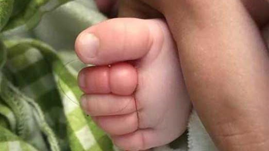 خصلة من شعرها كادت أن تؤدي لبتر أصابع طفلها