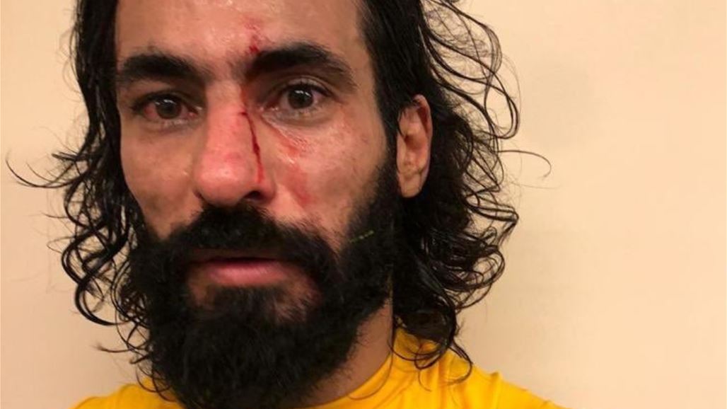 لاعب المنتخب السعودي يتعرض للضرب وآل شيخ يطالب بفتح تحقيق بالحادثة