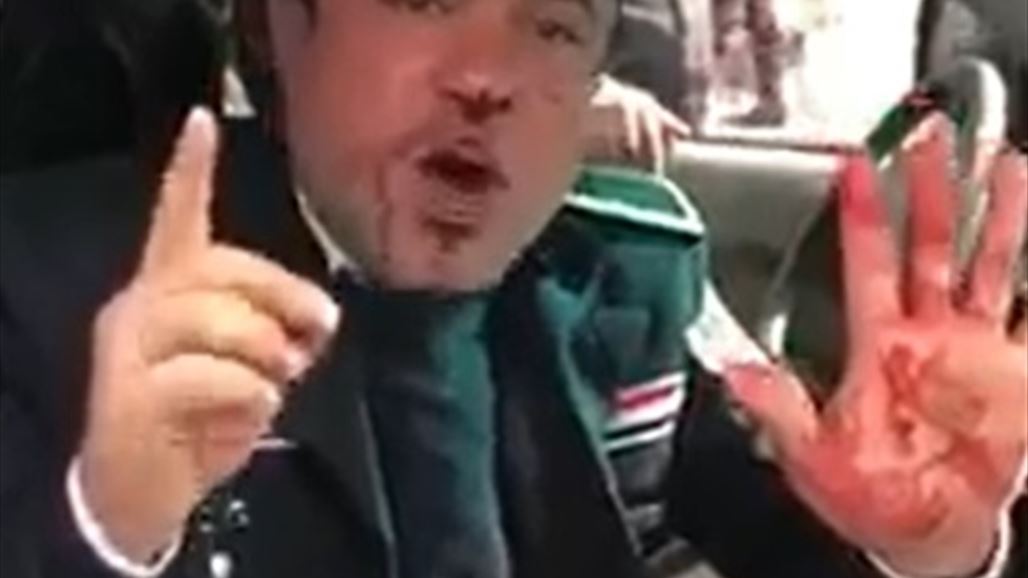 المرور تعلن متابعتها لحالة المنتسب الذي اعتدي عليه من قبل مكافحة الشغب في بغداد