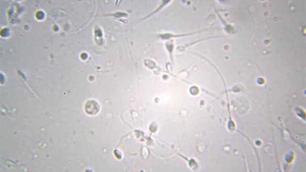 الصين تبتكر وسيلة خاصة بالرجال لمنع الحمل