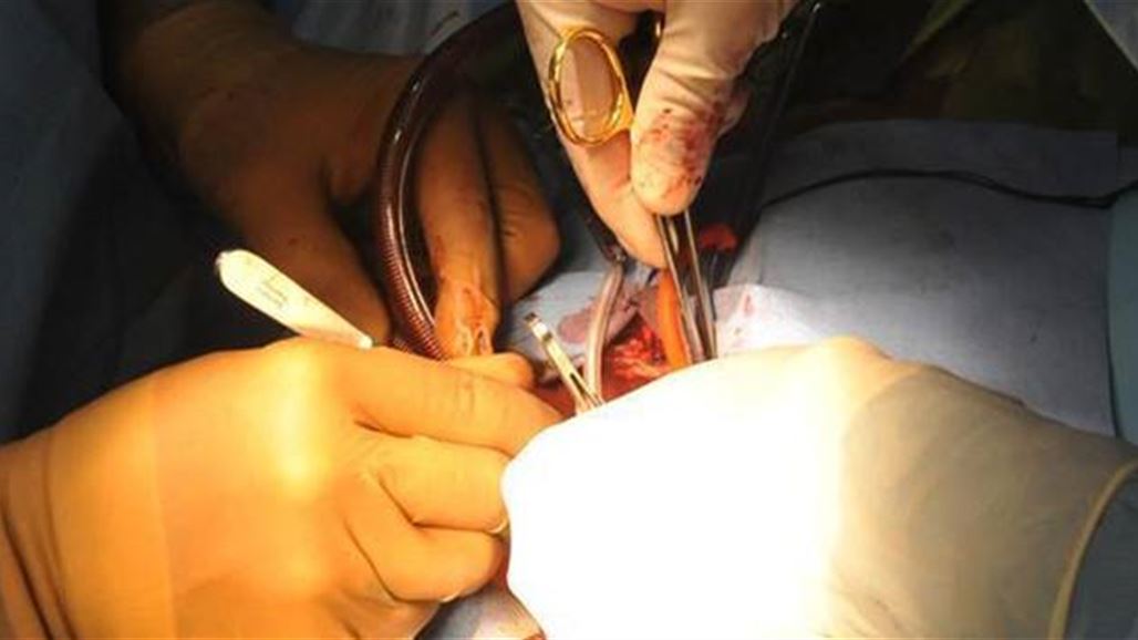 اختراع: "بنچرچي" للقلوب المجروحة