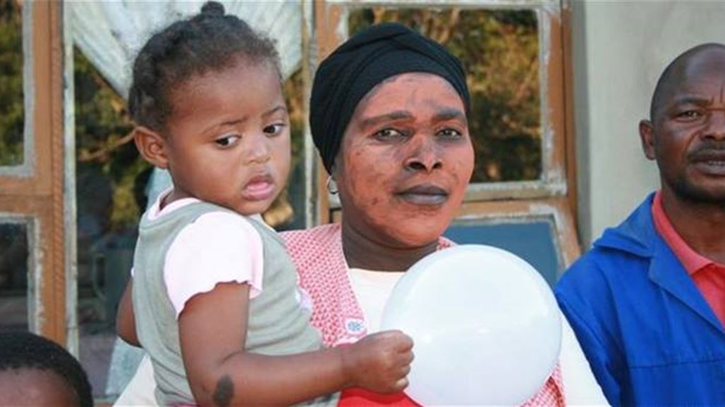 بشرة بلون القهوة باللبن..نساء يلهثن وراء البشرة الفاتحة