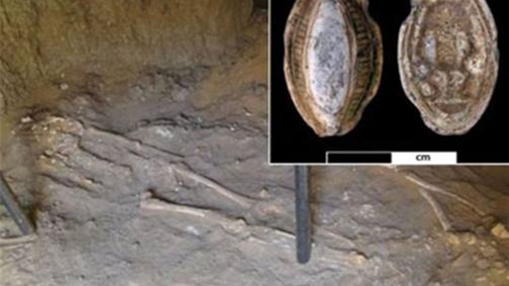 إصابة بالسرطان قبل 3000  سنة!
