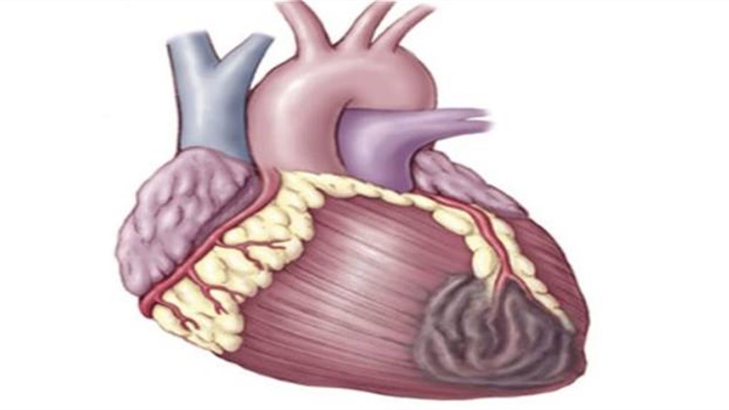 جراحة للقلب من دون شق الصدر