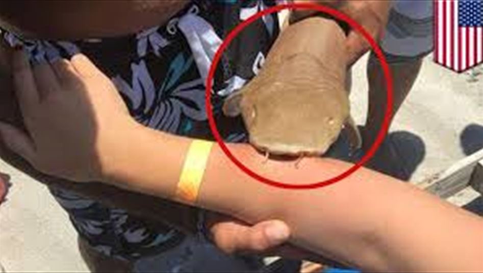 بالصور: تعلَّق قرشٌ بيدها!