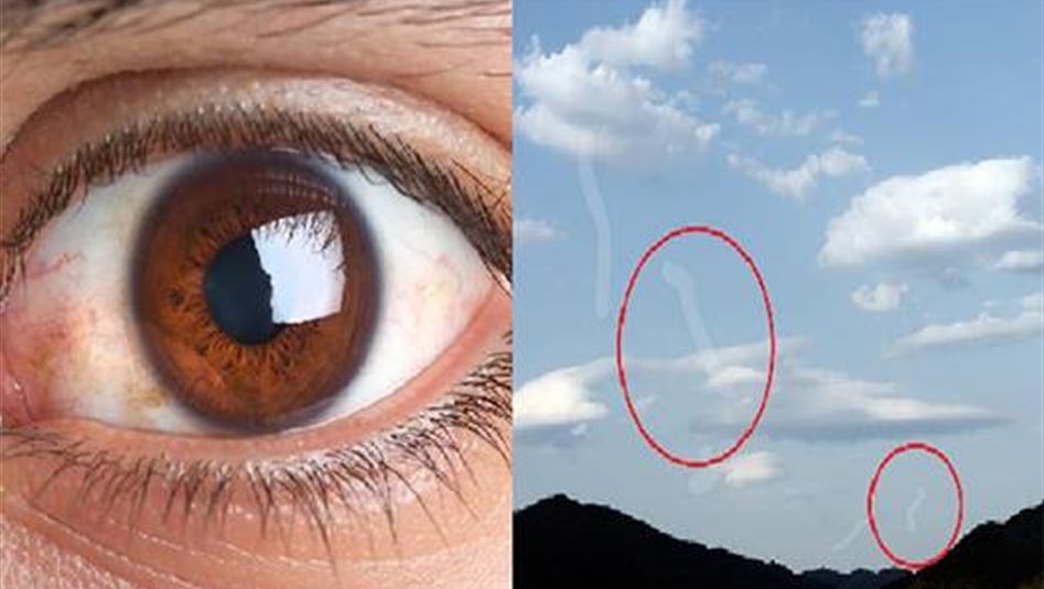 أترى بقعاً صغيرة تتحرك أمام عينيك؟ إكتشف السّبب...